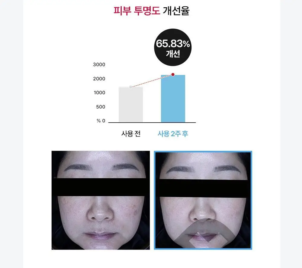 [2주 기미/잡티 삭제] 메디톡스 뉴라덤 하이드로 브라이트닝 마스크팩 1매/5매 (하이드로겔) 상세페이지 19